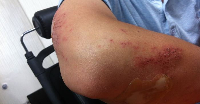 Help I am a man with a violent girlfriend suffering domestic violence.